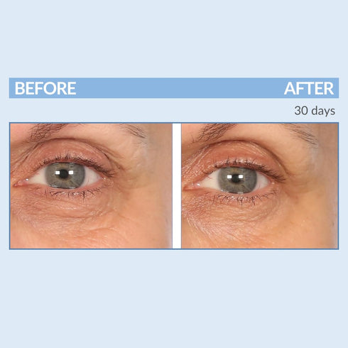 Serious Skincare Eyetality Morning Total Eye Care Cream - 0.5 oz, for Lines, Wrinkles, Puffiness & Dark Circles