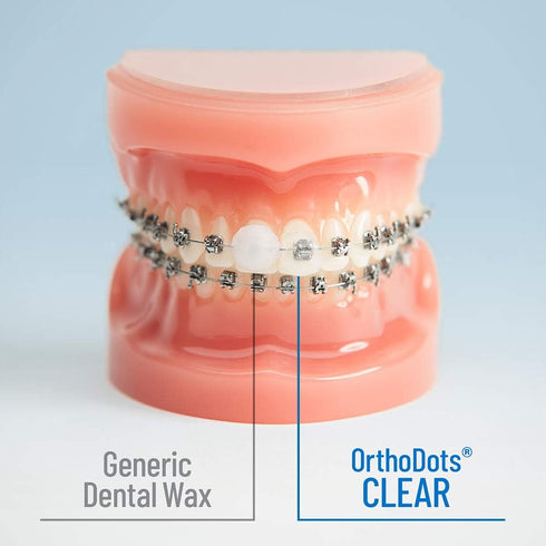 Orthodontic Wax Alternative, Clear Moisture Activated Braces Wax for Pain Relief, 72 Count