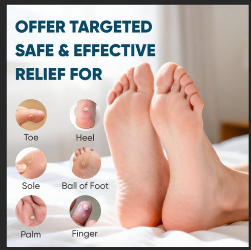 kindshine 96P 40% Corn Remover Pads for Feet and Toes, Extra Strength Salicylic Acid Medicated Patches, Effective