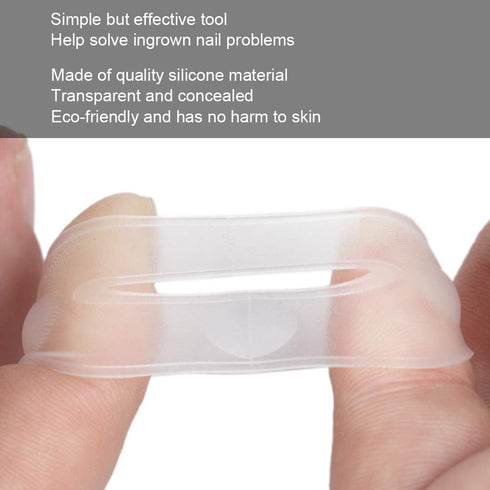 Silicone Ingrown Toenail Corrector, Treatment Tool for Nail Care, 1 Pair for Pedicure Recovery