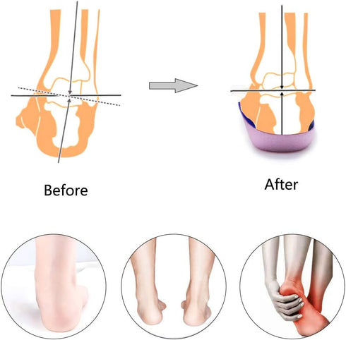 PCSsole’s 3/4 Orthotics Shoe Insoles, High Arch Supports for Plantar Fasciitis, Flat Feet, Relief Heel Spur Pain
