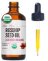 Kate Blanc Cosmetics Organic Rosehip Oil for Face & Skin (1oz, Pure, Cold Pressed)
