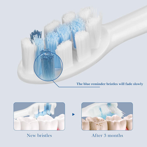 Linkidea Replacement Electric Toothbrush Head, 8 Pack, Soft Brush Heads Compatible with Philips Sonicare