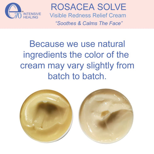 Rosacea Solve - Redness Relief Cream for Rosacea & Acne Prone Skin - Sensitive Skin Care with Organic Ingredients