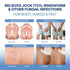 Hermon Folliculitis Treatment Cream & Antifungal Soap with Tea Tree Oil: Effective Treatment for Folliculitis Scalp
