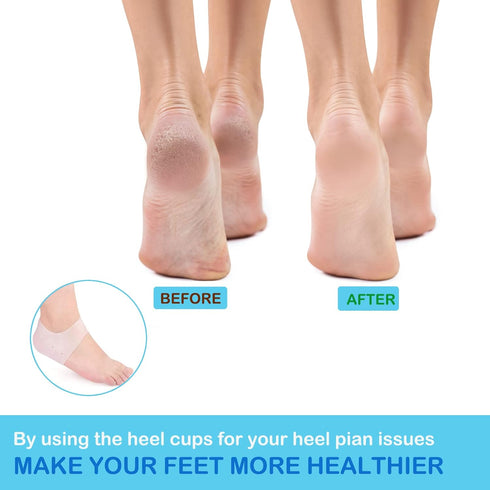 Wonderwin Gel Heel Cups, Medical-Grade Breathable Heel Protectors for Cracked Heels, Heel Spurs, Plantar Fasciitis, Men