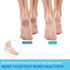 Wonderwin Gel Heel Cups, Medical-Grade Breathable Heel Protectors for Cracked Heels, Heel Spurs, Plantar Fasciitis, Men