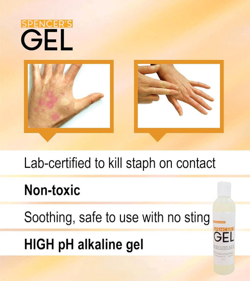 Spencer's Gel Alkaline Formula (8oz) - High-pH Solution for Stubborn Skin Issues, Non-Stinging