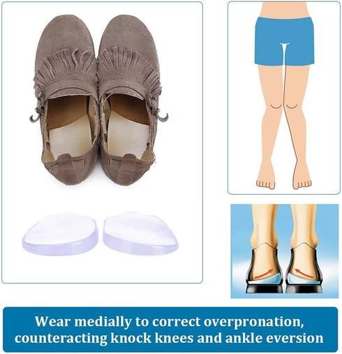 NEPPT Orthopedic Insoles Heel Inserts, Silicone Knee Pads for Women and Men, Corrective Support