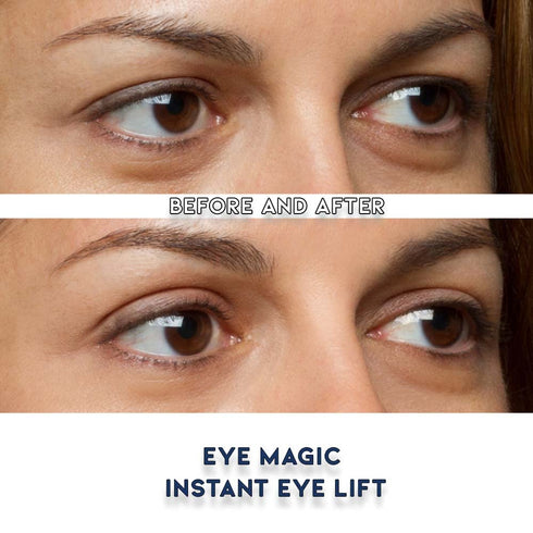 Original Eye Lift Kit, Small/Medium Size with Gel, Lifts Eyelid Droop and Hooded Eyes