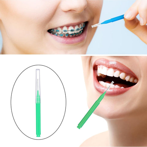Patelai 100 Pieces Braces Brush for Interdental Cleaning, Tooth Flossing Tool (Black, Blue, Green)