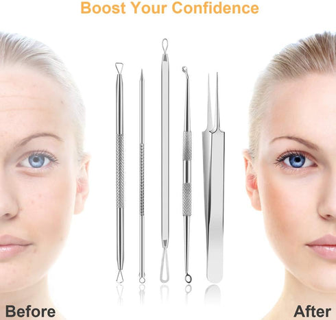 UUBAAR 9 PCS Pimple Popper Tool Kit, Blackhead Remover Tools with Tweezers for Facial Extraction