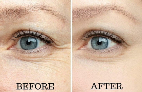 Osmotics Under Eye Rejuvenator, Anti Aging Eye Cream for Dark Circles, Puffiness, Fine Lines, and Wrinkles