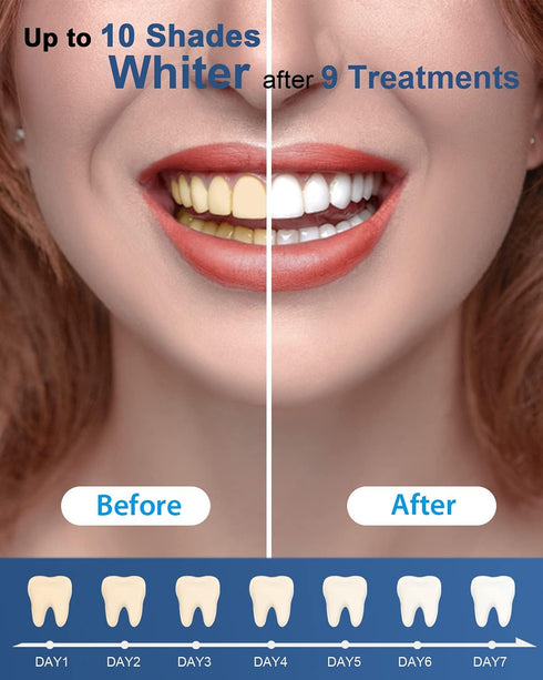 MySmile Teeth Whitening Gel Refills Pack, 6 Non-Sensitive Gel Pens for Fast Result Whitening
