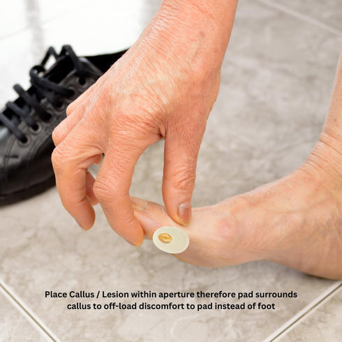 YJ9-7066, 1/8" (25 Pack) Dr. Jill's Foot Pads, Latex Free, Oval Callus Pad Felt Lesion Pad