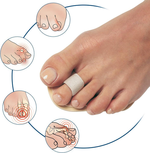 PediFix Toe Straightener Pedifix - P55, One Size Fits Most