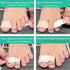 Big Toe Hammer Toe Wraps (10 Pack), Soft Padded Corrector for Pain Relief, Toe Bandages Protectors for Crooked, Curled,