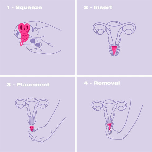 Intimina Lily Cup One – The Collapsible Menstrual Cup for Beginners, Teen Users