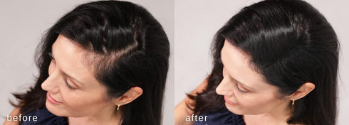 LUXE Hair Thickening Fibers - CONFIDENCE IN A JAR – Hypoallergenic, Dermatologist Tested – 2 Months+ Supply, Medium