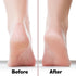 Probelle Double Sided Multidirectional Nickel Foot File Callus Remover - Safe Tool for Instant Results (Pink)