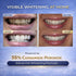 Pack 60 35% 310 mL Advanced White Teeth Whitening Gel Refill Treatments | Carbamide Peroxide Professional Dental-Grade