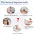 Ingrown Toenail Correction Patch, 50 Pcs Glue-free Stickers for Professional Foot Care