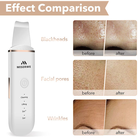 Skin Scrubber Face Spatula - Facial Scrubber for Deep Cleansing, Blackhead Remover, Pore Cleaner with 4 Modes (White)
