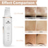 Skin Scrubber Face Spatula - Facial Scrubber for Deep Cleansing, Blackhead Remover, Pore Cleaner with 4 Modes (White)