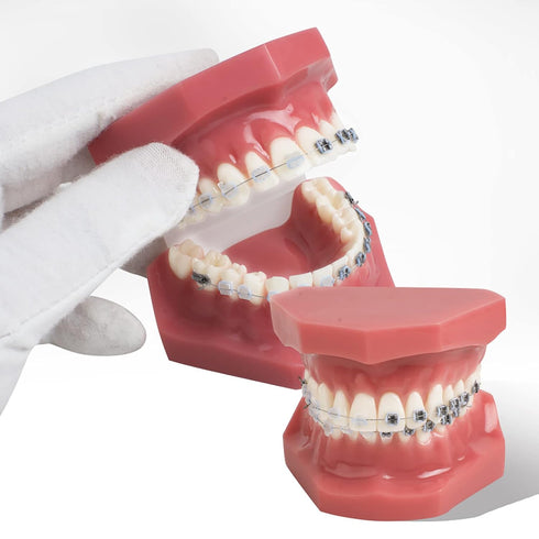 TM-208 Demonstration Orthodontic Model Teeth Teach Study Tools with Metal and Ceramic Bracket(Red)