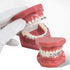 TM-208 Demonstration Orthodontic Model Teeth Teach Study Tools with Metal and Ceramic Bracket(Red)