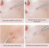 La chat Pimple Extractor Tools, Blackhead Remover, Acne Removal Kit for Blemish and Whitehead Treatment (2PCS)