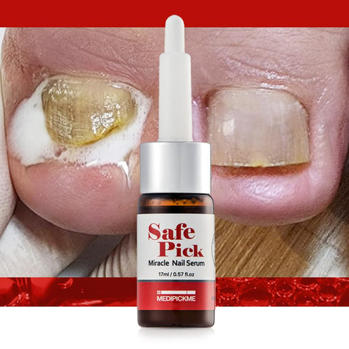 Safe Pick Miracle Nail Serum 17ml