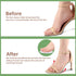 Metatarsal Pads for Women - Non-Slip High Heel Cushion, Soft Foot Pads for Ball of Foot Pain Relief (3 pairs: