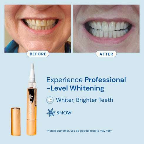 Snow Extra-Strength Teeth Whitening Serum - Whitening Pen for Stain Removal & Whiter Teeth - 2 Pack with Carbamide &