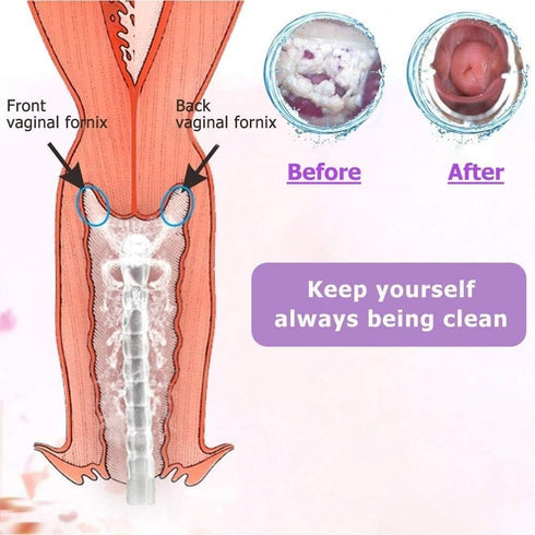 Kueysing 100% 300 ml 2 Nozzle Recommended (300ml) Reusable Vaginal Cleansing System Excellent Vaginal Cleanser Female