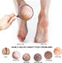 Pumice Stone Foot File (2-Pack), Wooden Handle Scrubber & Callus Remover for Dry Skin and Corns