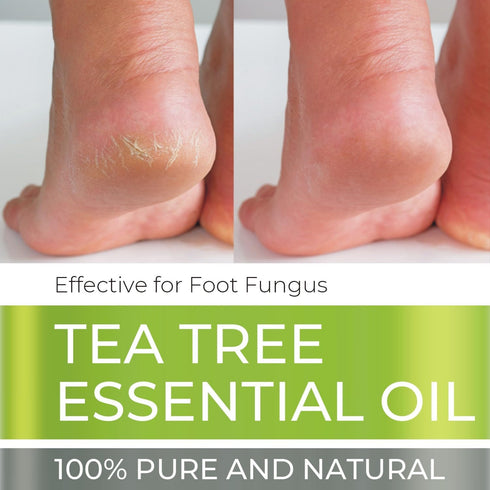 Tea Tree Essential Oil - 4 FL OZ - 100% Pure & Natural Premium Oil with Glass Dropper (Tea Tree)