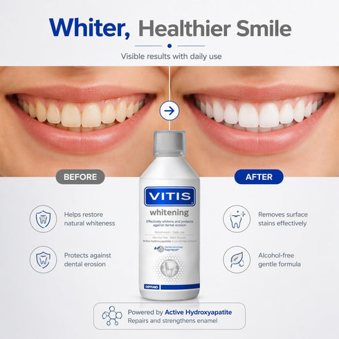 Vitis 500ml Whitening Mouthwash