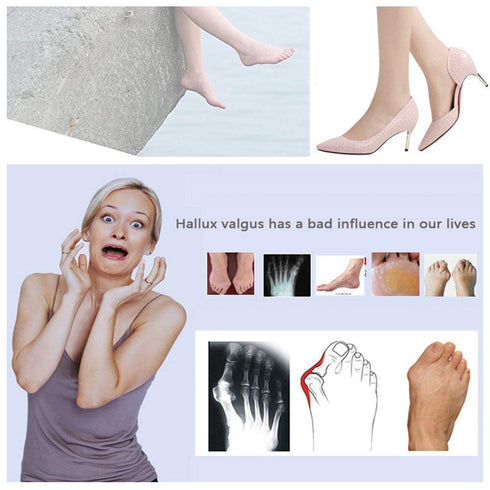 Bunion Corrector, Adjustable Bunion Splint Protector Sleeves Kit for Hallux Valgus, 7 Pcs for Women and Men