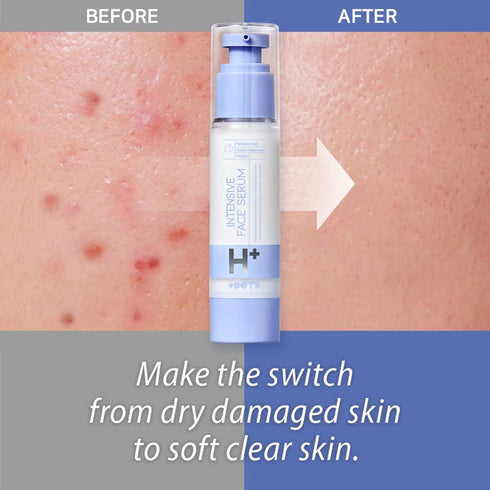 Intensive Hydrating Serum, Korean Moisturizing Face Serum with Hyaluronic Acid and Vitamin C, 50g
