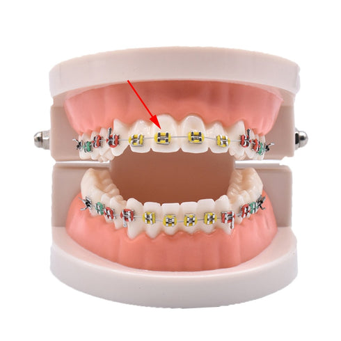 RZJZGZ Multi-Color Orthodontic Ligature Ties, 1040pcs Elastomeric O-Rings Braces Rubber Bands