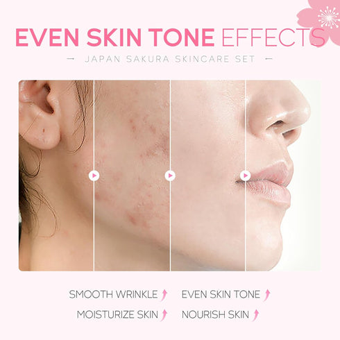 Skin Care Set JAPAN SAKURA Women Beauty Gift Set with Cleanser, Toner, Serum, Eye Cream, Face Cream (5pcs)