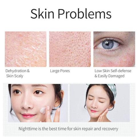Salicylic Acid Ice Cream Mask Acne Moisturizing Smear Mask Blackheads Remover Mask Cleansing & Shrinking Pores