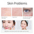 Salicylic Acid Ice Cream Mask Acne Moisturizing Smear Mask Blackheads Remover Mask Cleansing & Shrinking Pores