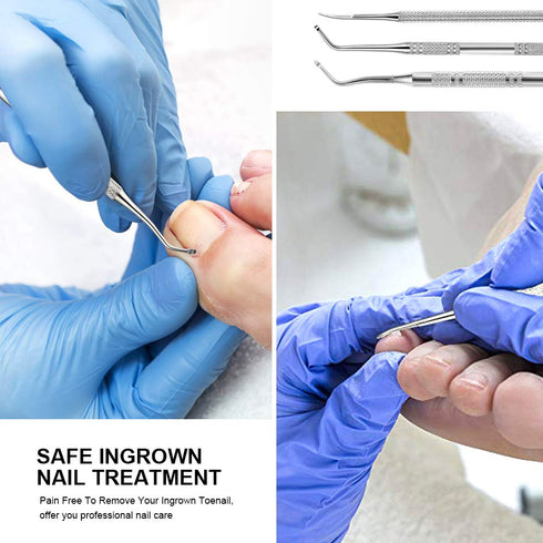 Teenitor Pedicure Tools for Feet - Toenail File and Lifters, Professional Safe Ingrown Toenail Treatment Kit