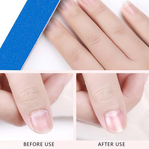 Mini Nail Files Bulk, 100 Pcs Disposable Double Sided Emery Boards, Travel Size for Men, Women, Kids (2 Inch)