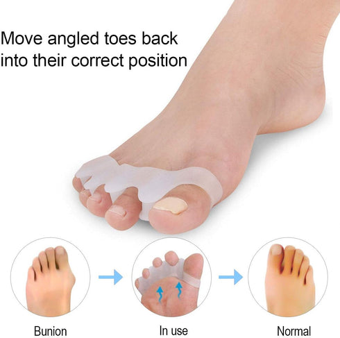 2 Pairs Toe Separators, Gel Toe Spacers for Bunion, Hammer Toe Straightener, Toe Correctors for Foot Pain Relief