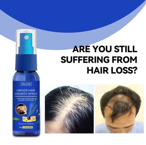 Ginger Hair Growth Spray | Promotes Thicker, Longer Hair with Ginger Extract for Scalp Moisturization and Regrowth
