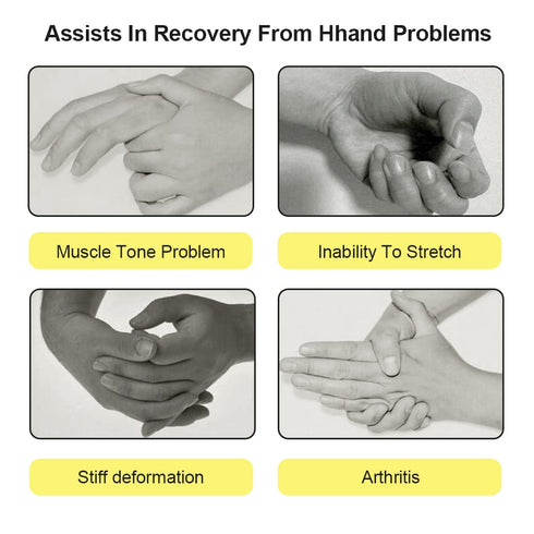 Resting Hand Straighten Splint, Night Finger Separator Support Rehab Training Supplies for Arthritis, Hemiplegia, Spasm