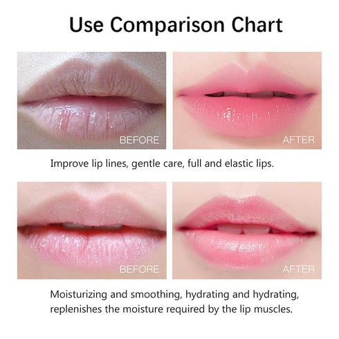20Pcs Moisturizing/Plumping Lip Mask, Gel Treatment Masks for Dry Lips and Lines Overnight Care (Pink)